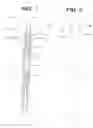 Fig. 02 - Extramedullary fluoroscopic alignment guide