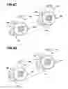 Fig. 07 - Implantable bone distraction device and method