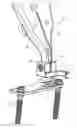 Fig. 01 - Multi-function orthopedic instrument