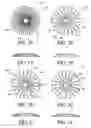 Fig. 06 - Ocular inlay with locator