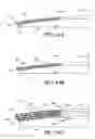 Fig. 10 - Ocular inlay with locator