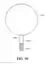 Fig. 25 - Ocular inlay with locator