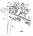 Fig. 04 - Lead extraction device