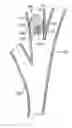 Fig. 01 - Intra-bronchial obstructing device that controls biological interaction with the patient