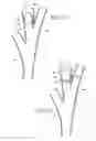 Fig. 04 - Intra-bronchial obstructing device that controls biological interaction with the patient