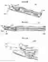 Fig. 19 - Clip applier with migrational resistance features