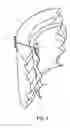 Fig. 04 - Article, system, and method for securing medical device to tissue or organ