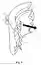 Fig. 05 - Article, system, and method for securing medical device to tissue or organ