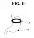 Fig. 03 - Artificial gastric valve