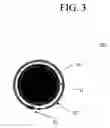 Fig. 05 - Artificial gastric valve