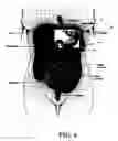 Fig. 08 - Artificial gastric valve