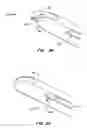 Fig. 09 - Vascular intimal lining removal assembly