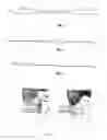 Fig. 02 - Surgical device and method for cutaneous detachment of skin