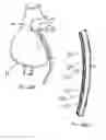 Fig. 43 - Instruments having a rigidizable external working channel