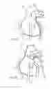 Fig. 47 - Instruments having a rigidizable external working channel