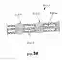Fig. 52 - Instruments having a rigidizable external working channel