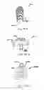 Fig. 53 - Instruments having a rigidizable external working channel