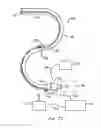 Fig. 06 - Instruments having an external working channel