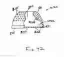 Fig. 55 - Instruments having an external working channel