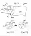 Fig. 58 - Instruments having an external working channel