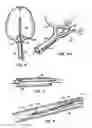 Fig. 04 - Cavity formation device