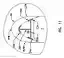 Fig. 10 - Pharyngeal wall treatment
