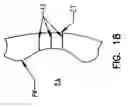Fig. 17 - Pharyngeal wall treatment