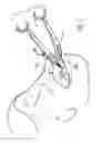 Fig. 02 - Forceps and system using same