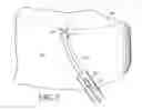 Fig. 03 - Removable anchored lung volume reduction device and methods