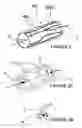 Fig. 03 - Methods and apparatus for multi-vessel renal neuromodulation