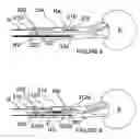 Fig. 06 - Methods and apparatus for multi-vessel renal neuromodulation