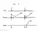 Fig. 08 - Method and apparatus for identifying oversensing using far-field intracardiac electrograms and marker channels