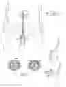 Fig. 06 - Controlled penile prosthesis
