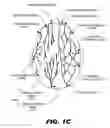 Fig. 04 - Stimulation of a stimulation site within the neck or head