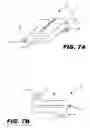 Fig. 10 - Stimulation of a stimulation site within the neck or head