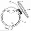 Fig. 01 - Visual prosthesis including enhanced receiving and stimulating portion