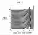 Fig. 02 - Sound processor for a cochlear implant