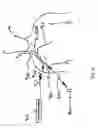 Fig. 10 - Patient event marking in combination with physiological signals