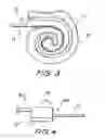 Fig. 03 - Optic fibre device
