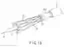 Fig. 13 - Stent delivery system