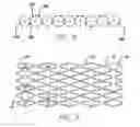 Fig. 04 - Intravascular stent