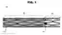 Fig. 02 - Overlapping coated stents method