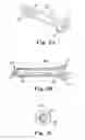 Fig. 03 - Prosthetic heart valve system