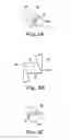 Fig. 04 - Prosthetic heart valve system