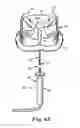 Fig. 06 - Prosthetic heart valve system