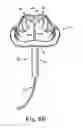 Fig. 07 - Prosthetic heart valve system