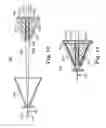 Fig. 10 - Prosthetic heart valve system