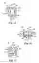 Fig. 14 - Prosthetic heart valve system