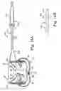 Fig. 15 - Prosthetic heart valve system