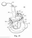 Fig. 16 - Prosthetic heart valve system